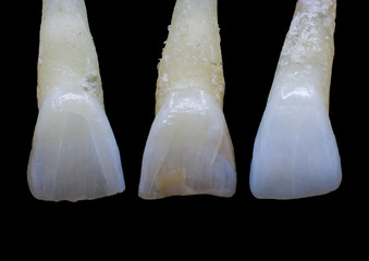 Close up of three natural teeth