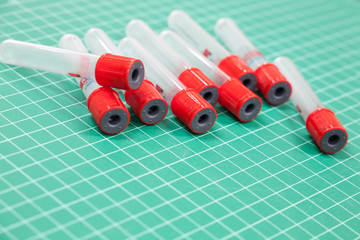 Group of empty blood sample tubes on green cutting mat with space for text, red cap plastic tube...