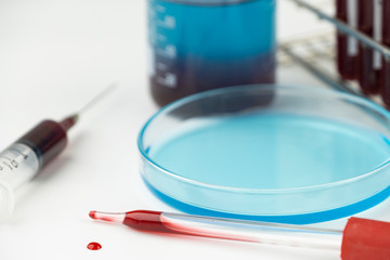 Methylene blue test liquid with blood sample for test, laboratory sample of blood testing for diagnosis virus infection, the pandemic infectious concept