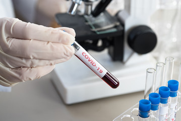 Nurse holding test tube with blood for nCoV-2019 analyzing, coronavirus test concept in laboratory