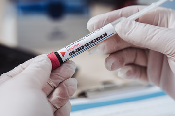 Fototapeta premium Analysis of tube with biological sample contaminated by Coronavirus. Doctor's hands wearing silicone gloves. Positive results. The doctor is making notes after giving a medicine. Medical exam.