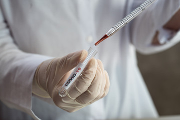 Nurse holding test tube with blood for nCoV-2019 analyzing, coronavirus test concept in laboratory