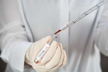 Nurse holding test tube with blood for nCoV-2019 analyzing, coronavirus test concept in laboratory