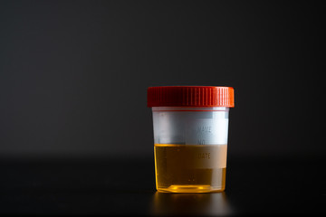 a jar with a urine test on a dark background