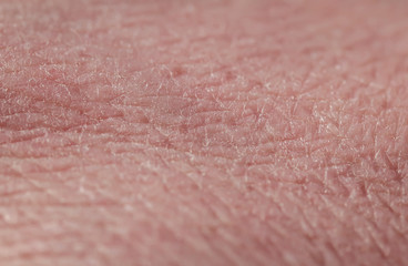background with the texture of pink unhealthy chapped human skin covered with deep wrinkles and dry scales and cracks
