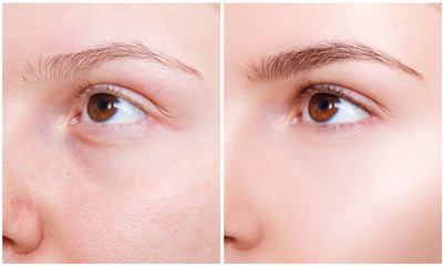 Female eyes closeup before and after eyebrows correction and dying.