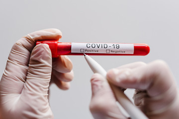 Coronavirus. A hands of doctor, nurse writing a note with a pen, holds tube containing a patient’s blood sample at laboratory. COVID-19. Conduct laboratory testing - Positive result. 2019-nCoV virus.