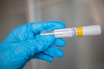 Naklejka premium Coronavirus - Epidemic Outbreak.