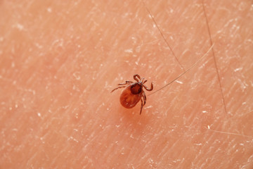 Tick (Ixodes ricinus) on skin. Dangerous mite, can cause Lyme disease (borreliosis), tick-borne encephalitis and ehrlichiosis. Europe, Czech Republic