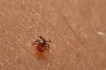 Tick (Ixodes ricinus) on skin. Dangerous mite, can cause Lyme disease (borreliosis), tick-borne encephalitis and ehrlichiosis. Europe, Czech Republic