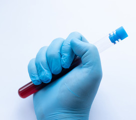 A doctor in disposable latex gloves holds a test tube with a blood sample.