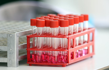 Coronavirus nasal swab test tubes