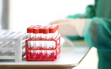 Coronavirus nasal swab test tubes