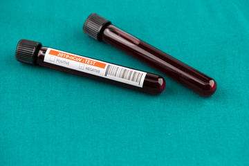 Test tube with blood sample in lab for COVID-19 test on surgical green drape, laboratory sample of blood testing for diagnosis new Corona virus infection, the pandemic infectious concept