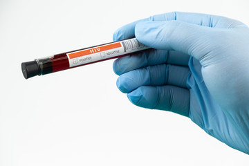 Test tube with blood sample in lab for COVID-19 test in hand of doctor wear blue glove, laboratory sample of blood testing for diagnosis new Corona virus infection, the pandemic infectious concept