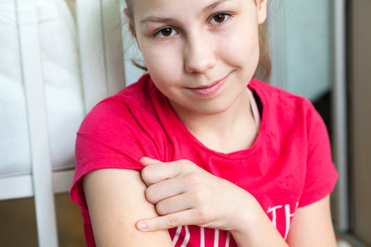 Preteen smiling girl portrait with BSG scar on her shoulder, showing place of vaccination with finger