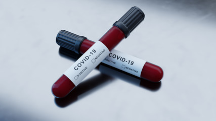 COVID-19 TEST CORONAVIRUS