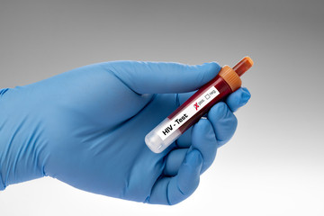 Blood test, HIV, AIDS test - test sample tube