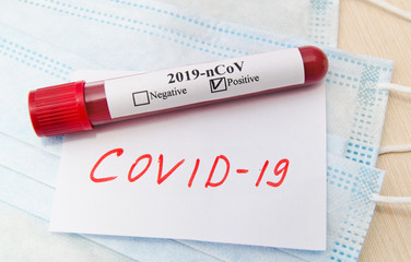 Coronavirus Covid-19 blood test concept.  Test tube with coronavirus positive blood and note covid-19 over laboratory desk