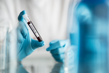 scientist holding blood test tube with covid-19 or coronavirus label, lab testing for inventing pandemic medication