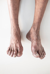 Portrait of feet and legs of an old man on a white background
