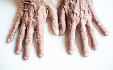 The image of the wrinkled hand and fingers of an old person