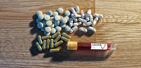 Coronavirus. Sars-Co-2. Sars - 19. SARS-CoV-2. Infektionstest.