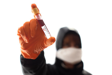 Coronavirus. Sars-Co-2. Sars - 19. SARS-CoV-2. Infektions Test.	
