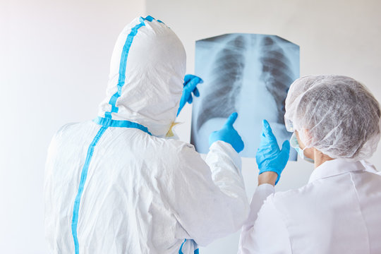 Doctors with x-ray picture of pneumonia in clinic