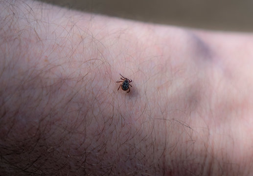Ixodoidea mite crawls on human skin close up