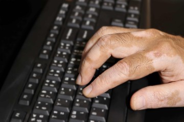 Hand with vitiligo on keyboard of computer with copy space.