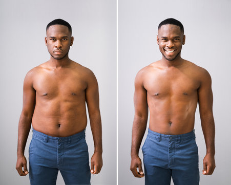 Man Before And After Weight Loss