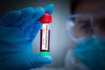 Coronavirus Covid 19 infected blood sample in sample tube in hand of scientist doctor biohazard...