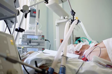 Foto op Plexiglas Coronavirus pandemic. Patient with coronavirus pneumonia in critical state. Intubated senior under ventilator lying in coma in intensive care department. © Kiryl Lis
