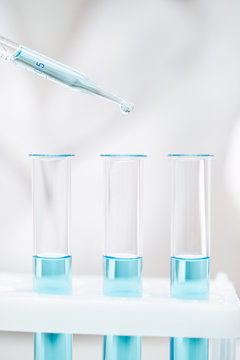 clean glass tubes and pipette with light blue reagent for coronavirus test in modern laboratory extreme closeup