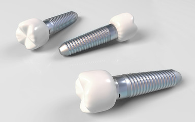 Dental implants illustration with white background