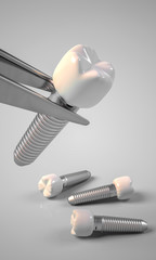 Dental implants with tweezers and white background illustration