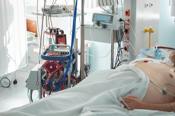 Patient with coronavirus infection in critical stance. Working ecmo machine in intensive care department, closeup oxygenator.