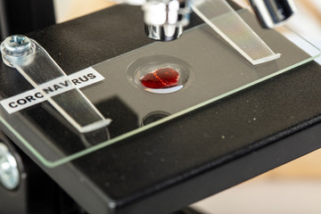 blood sample under a microscope in a laboratory, concept for testing for virus infection