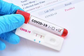 Obraz premium Positive test result by using rapid test device for COVID-19 virus