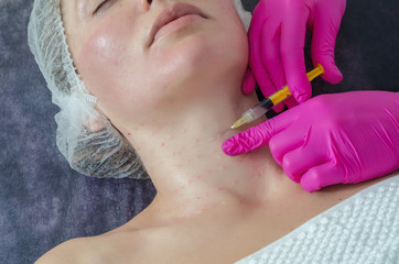 Mesotherapy of the face and neck. Beautician makes injection of beauty into the face of patient