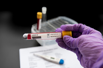 Coronavirus NCoV-2019 blood test interpretation