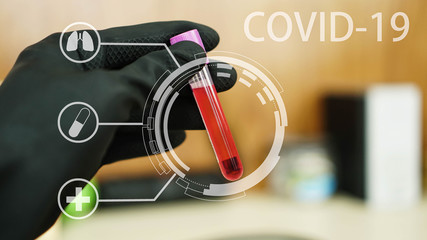 Coronavirus COVID-19 infected blood sample Test tube with blood sample for COVID-19 test, novel coronavirus 2019 prevent virus and plague infection