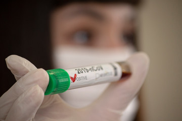 A woman doctor holds a positive coronavirus test tube in her hand. Positive covid-19 test tube. 