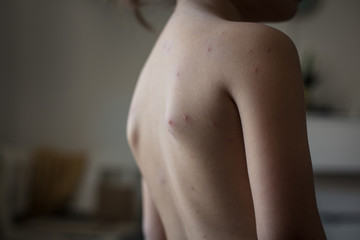 This is nothing terrible.