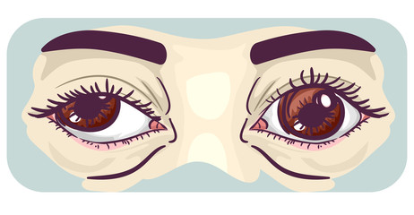 Symptom Lazy Eye Illustration