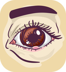 Symptom Eye Stye Illustration