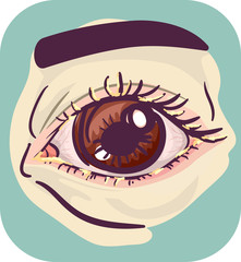 Symptoms Crusty Eye Illustration