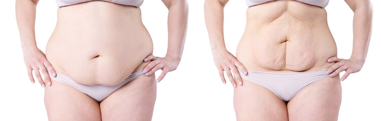 Woman's body before and after weight loss isolated on white background