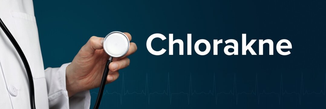 Chlorakne. Arzt im Kittel hält Stethoskop. Das Wort Chlorakne steht daneben. Symbol für Medizin, Krankheit, Gesundheit